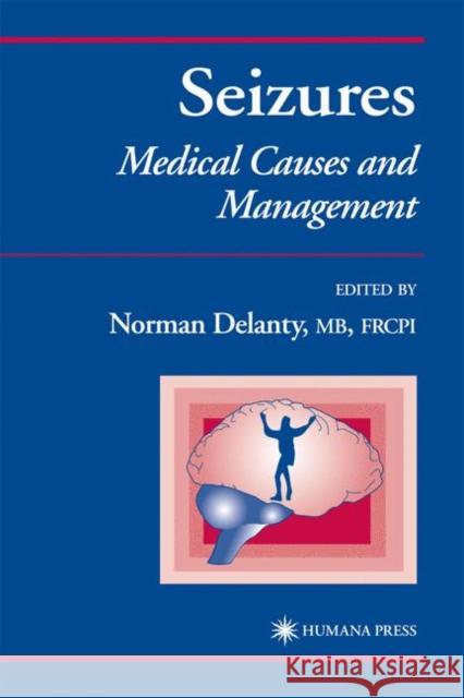 Seizures: Medical Causes and Management Delanty, Norman 9781617372070 Springer - książka