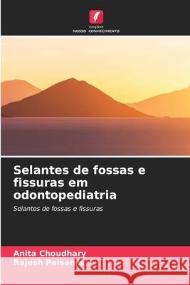 Selantes de fossas e fissuras em odontopediatria Choudhary, Anita, Palsania, Rajesh 9786209391187 Edições Nosso Conhecimento - książka
