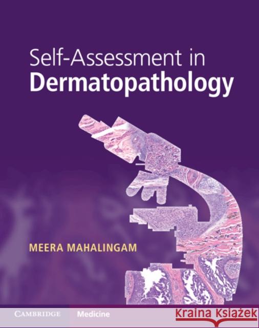 Self-Assessment in Dermatopathology Meera Mahalingam 9781316622872 Cambridge University Press - książka