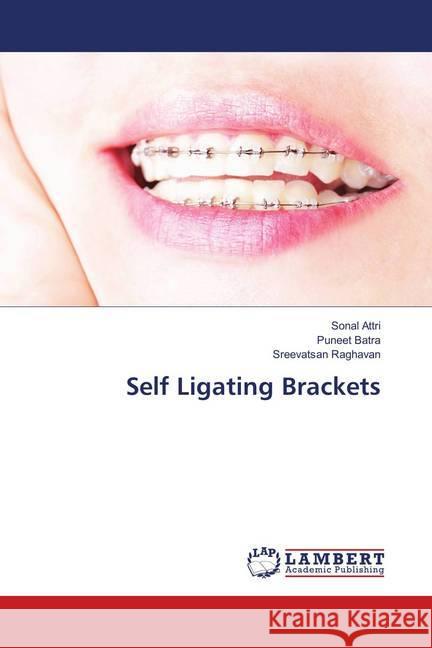 Self Ligating Brackets Attri, Sonal; Batra, Puneet; Raghavan, Sreevatsan 9786139574261 LAP Lambert Academic Publishing - książka