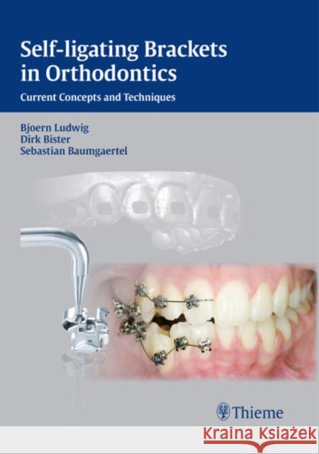 Self-Ligating Brackets in Orthodontics: Current Concepts and Techniques Bister, Dirk 9783131547019 Thieme, Stuttgart - książka