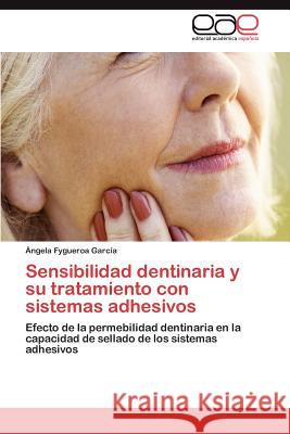 Sensibilidad dentinaria y su tratamiento con sistemas adhesivos Fygueroa García Ángela 9783846570357 Editorial Acad Mica Espa Ola - książka
