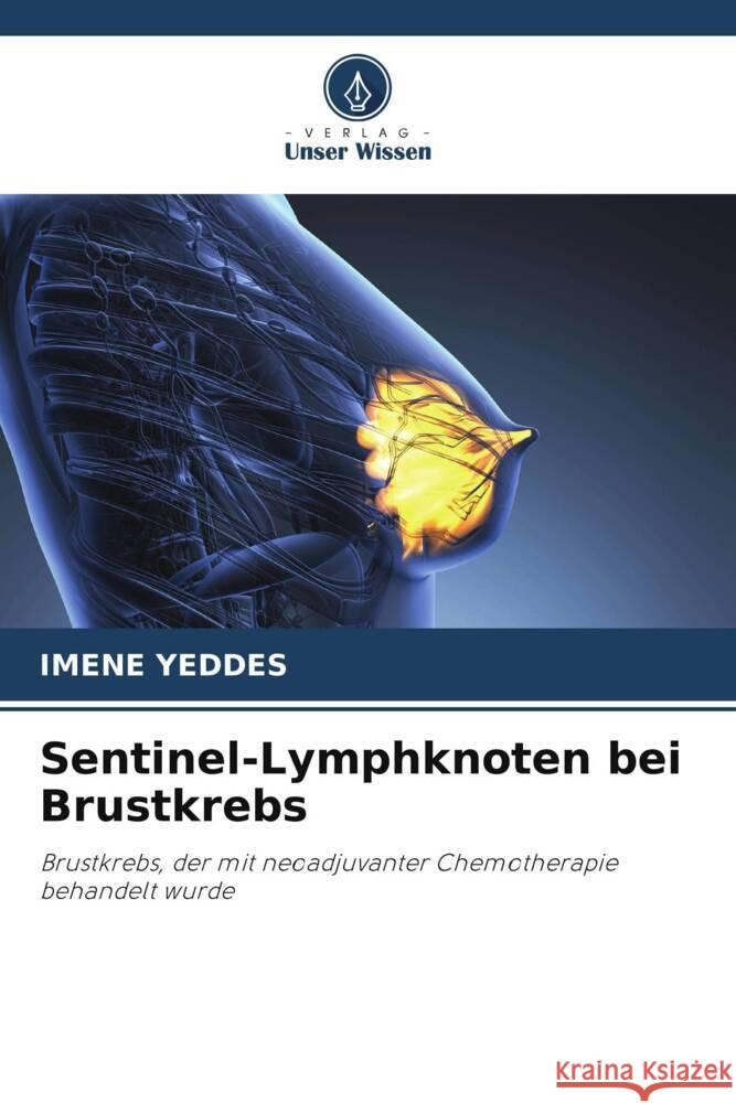 Sentinel-Lymphknoten bei Brustkrebs Yeddes, Imene 9786205233832 Verlag Unser Wissen - książka