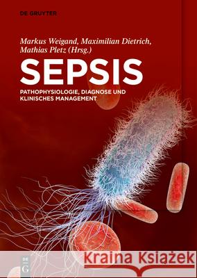 Sepsis No Contributor 9783110673364 de Gruyter - książka
