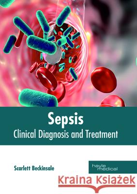 Sepsis: Clinical Diagnosis and Treatment Scarlett Beckinsale 9781632415172 Hayle Medical - książka