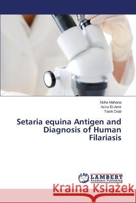 Setaria equina Antigen and Diagnosis of Human Filariasis Mahana Noha                              El-Amir Azza                             Diab Tarek 9783659802737 LAP Lambert Academic Publishing - książka