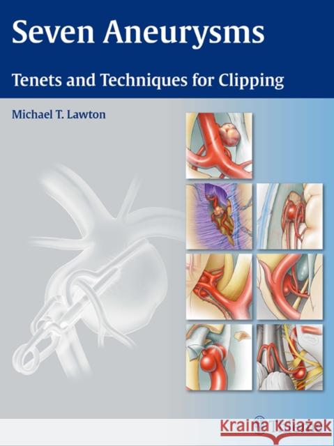 Seven Aneurysms: Tenets and Techniques for Clipping Lawton, Michael T. 9781604060546 Thieme Medical Publishers - książka