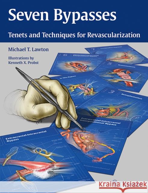 Seven Bypasses: Tenets and Techniques for Revascularization Lawton, Michael T. 9781626234833 Thieme Medical Publishers - książka