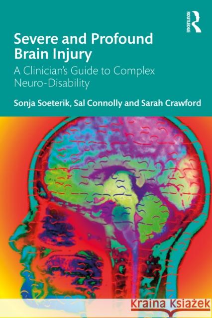 Severe and Profound Brain Injury: A Clinician's Guide to Complex Neuro-Disability Sarah Crawford 9781032665931 Routledge - książka
