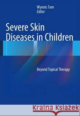 Severe Skin Diseases in Children: Beyond Topical Therapy Tom, Wynnis L. 9783642395314 Springer - książka
