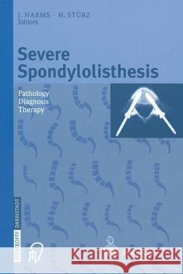 Severe Spondylolisthesis: Pathology - Diagnosis - Therapy Harms, J. 9783642632853 Steinkopff-Verlag Darmstadt - książka