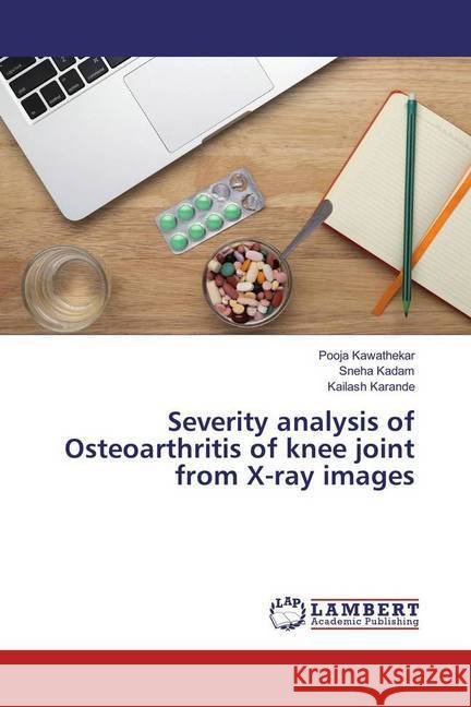 Severity analysis of Osteoarthritis of knee joint from X-ray images Kawathekar, Pooja; Kadam, Sneha; Karande, Kailash 9783659974229 LAP Lambert Academic Publishing - książka