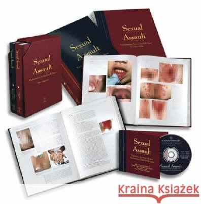 Sexual Assault : Victimization Across the Life Span Angelo P. Giardino Elizabeth M. Datner Janice B. Asher 9781878060471 W.B. Saunders Company - książka