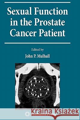 Sexual Function in the Prostate Cancer Patient John P. Mulhall 9781617379093 Springer - książka