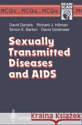 Sexually Transmitted Diseases and AIDS David Daniels Richard J. Hillman Simon E. Barton 9783540197621 Springer - książka