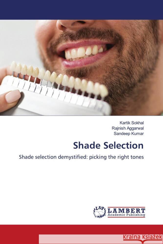 Shade Selection Sokhal, Kartik, AGGARWAL, RAJNISH, Kumar, Sandeep 9786206779759 LAP Lambert Academic Publishing - książka