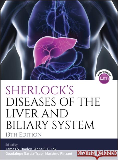 Sherlock's Diseases of the Liver and Biliary System James S. Dooley Anna S. F. Lok Guadalupe Garcia-Tsao 9781119237549 Wiley-Blackwell - książka