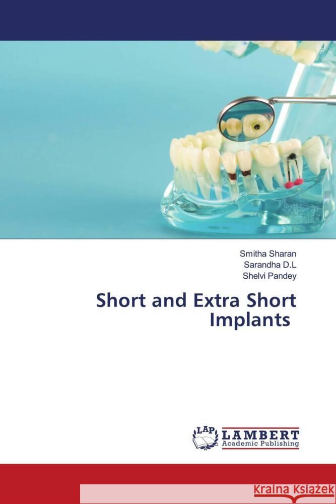 Short and Extra Short Implants Sharan, Smitha, D.L, Sarandha, Pandey, Shelvi 9786207448739 LAP Lambert Academic Publishing - książka