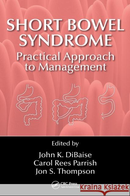 Short Bowel Syndrome: Practical Approach to Management John K. DiBaise Carol Rees Parrish Jon S. Thompson 9781498720786 Taylor and Francis - książka