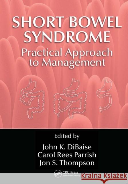 Short Bowel Syndrome Practical Approach to Management: Practical Approach to Management Dibaise, John K. 9781032097855 CRC Press - książka