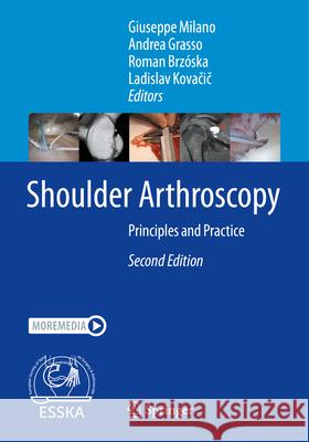 Shoulder Arthroscopy  9783662668702 Springer Berlin Heidelberg - książka