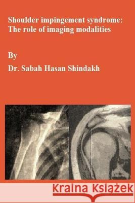 Shoulder impingement syndrome: The role of imaging modalities: Master thesis Shindakh, Sabah Hasan 9781729543641 Createspace Independent Publishing Platform - książka