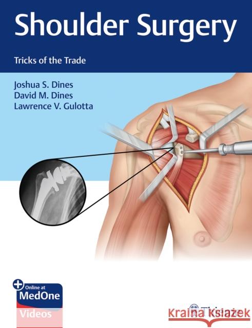 Shoulder Surgery: Tricks of the Trade Dines, Joshua 9781626235168 Thieme Medical Publishers - książka