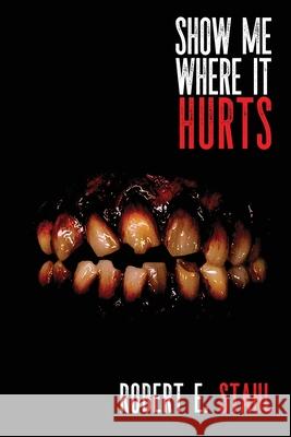 Show Me Where It Hurts Robert E. Stahl 9781685101565 JournalStone - książka