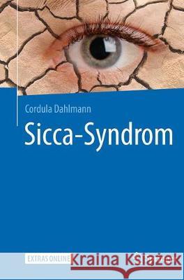 Sicca-Syndrom Cordula Dahlmann 9783662564080 Springer - książka