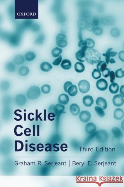 Sickle Cell Disease  Serjeant 9780192630360  - książka