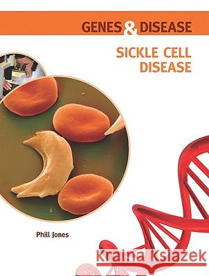 Sickle Cell Disease Phill Jones Phill Jones 9780791095874 Chelsea House Publishers - książka