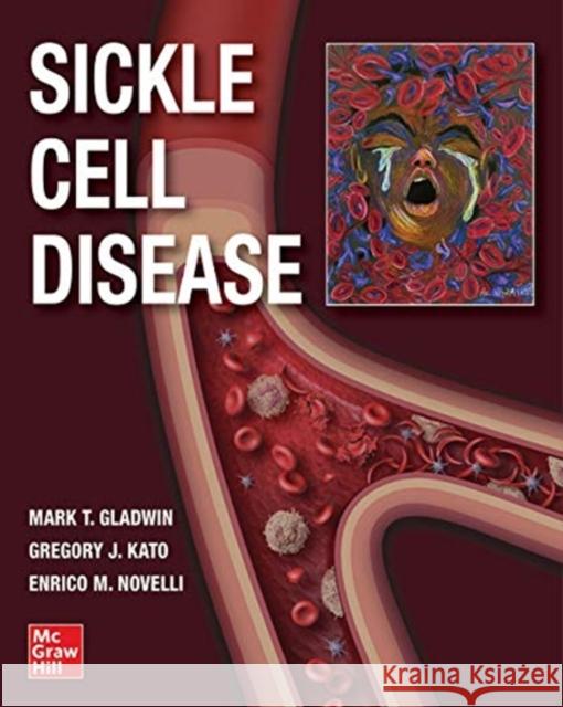 Sickle Cell Disease Mark T. Gladwin Gregory Kato Enrico Novelli 9781260458596 McGraw-Hill Education / Medical - książka