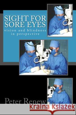 Sight For Sore Eyes: vision and blindness in perspective Renew, Peter Jonathan 9781492261827 Createspace - książka