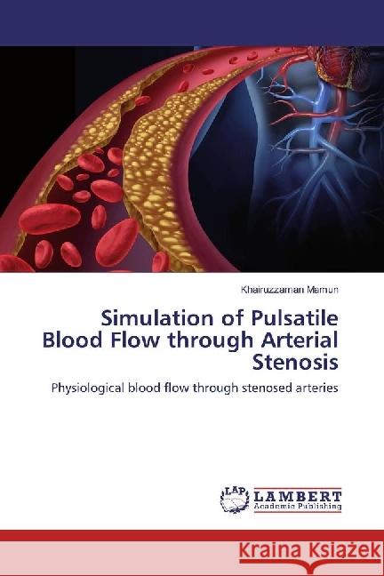 Simulation of Pulsatile Blood Flow through Arterial Stenosis : Physiological blood flow through stenosed arteries Mamun, Khairuzzaman 9783659931710 LAP Lambert Academic Publishing - książka