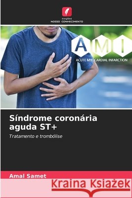 Síndrome coronária aguda ST+ Samet, Amal 9786208656713 Edições Nosso Conhecimento - książka