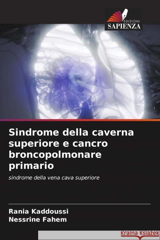 Sindrome della caverna superiore e cancro broncopolmonare primario Rania Kaddoussi Nessrine Fahem 9786208102166 Edizioni Sapienza - książka