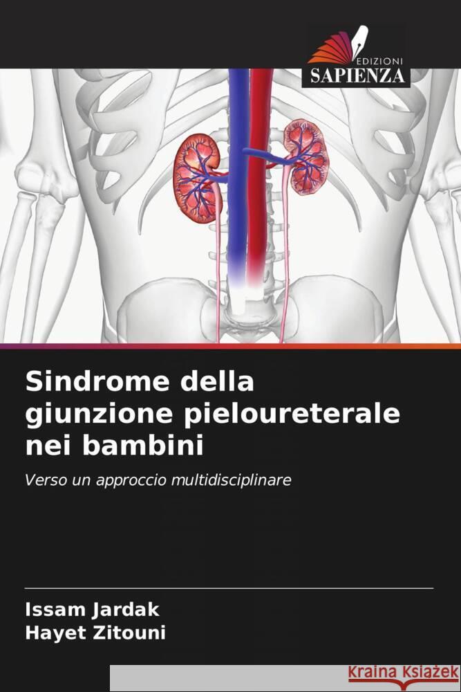 Sindrome della giunzione pieloureterale nei bambini JARDAK, Issam, Zitouni, Hayet 9786206631705 Edizioni Sapienza - książka