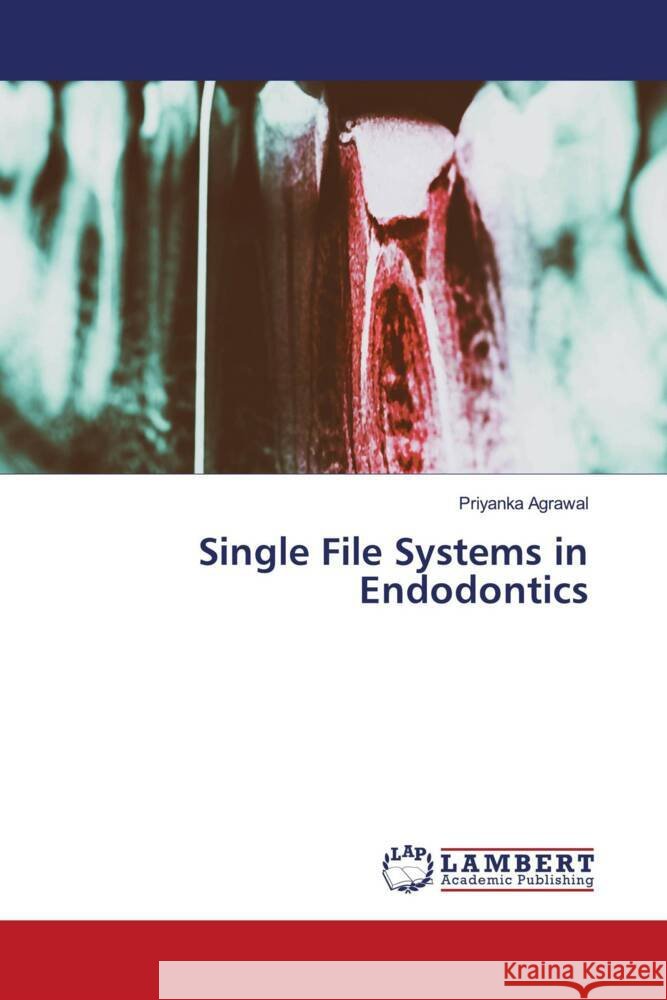 Single File Systems in Endodontics Agrawal, Priyanka 9786204956671 LAP Lambert Academic Publishing - książka
