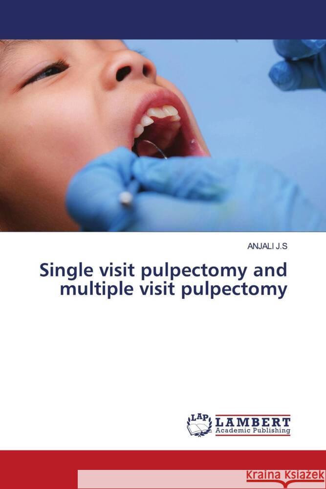 Single visit pulpectomy and multiple visit pulpectomy J.S, ANJALI 9786208433406 LAP Lambert Academic Publishing - książka