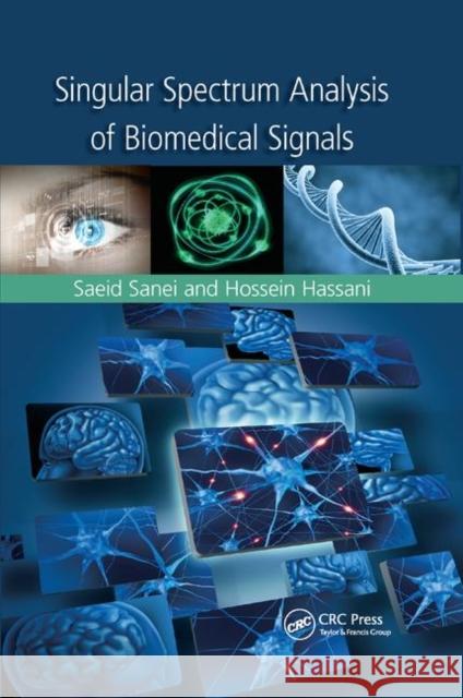 Singular Spectrum Analysis of Biomedical Signals Saeid Sanei Hossein Hassani 9780367377045 CRC Press - książka