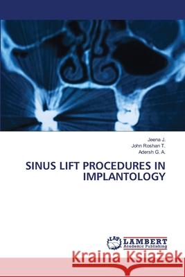 SINUS LIFT PROCEDURES IN IMPLANTOLOGY J., Jeena, Roshan T., John, G. A., Adersh 9786207995110 LAP Lambert Academic Publishing - książka