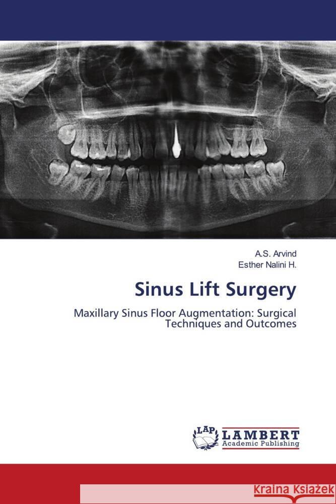 Sinus Lift Surgery Arvind, A.S., Nalini H., Esther 9786208223298 LAP Lambert Academic Publishing - książka