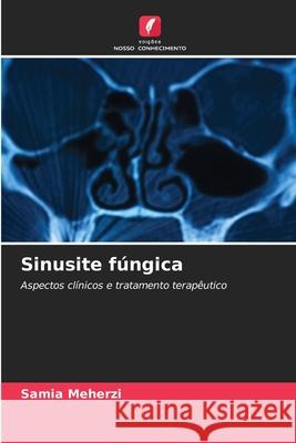 Sinusite fúngica Meherzi, Samia 9786208954499 Edições Nosso Conhecimento - książka