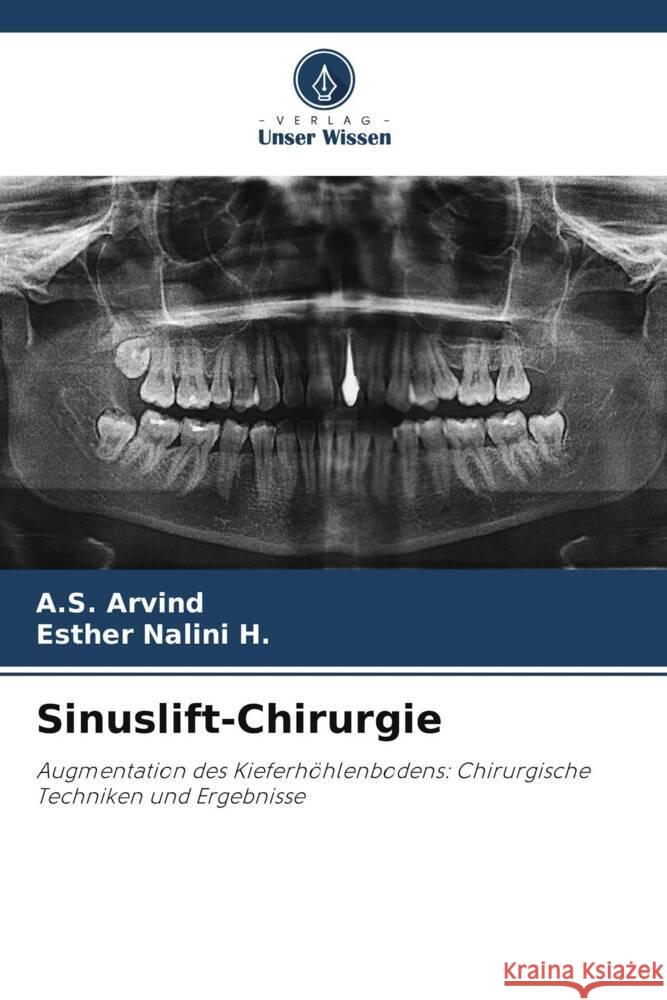 Sinuslift-Chirurgie Arvind, A.S., Nalini H., Esther 9786208268183 Verlag Unser Wissen - książka