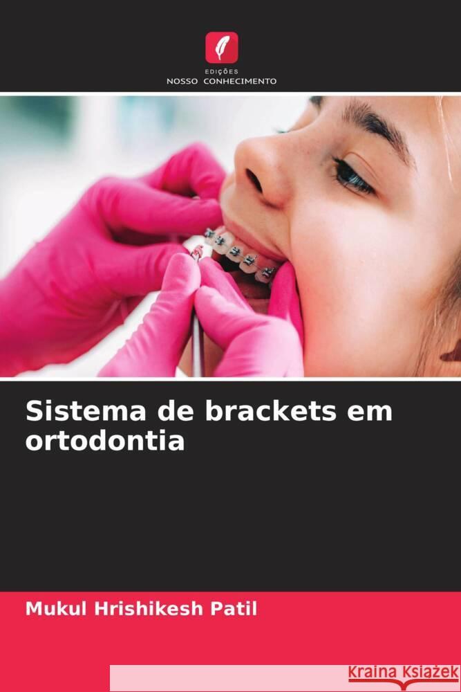 Sistema de brackets em ortodontia Mukul Hrishikes 9786206919001 Edicoes Nosso Conhecimento - książka