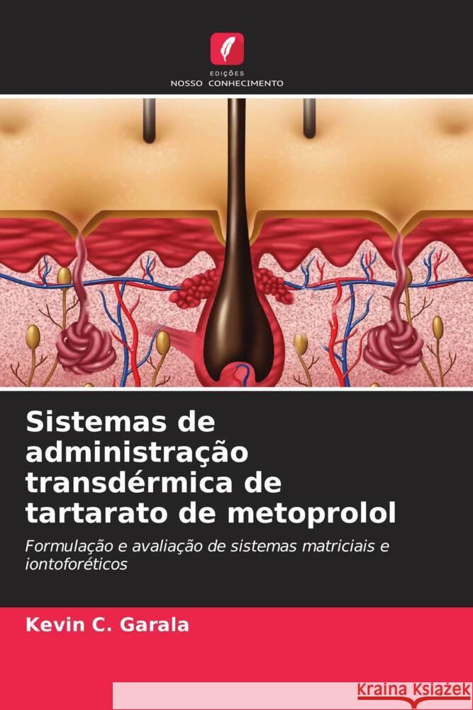 Sistemas de administração transdérmica de tartarato de metoprolol Garala, Kevin C. 9786208309237 Edições Nosso Conhecimento - książka