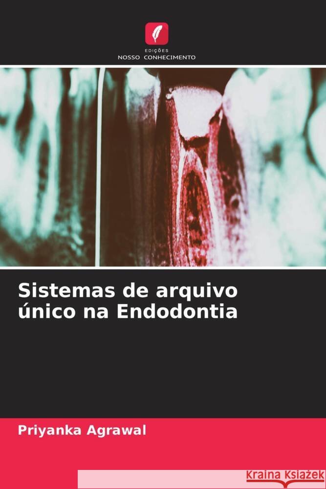 Sistemas de arquivo único na Endodontia Agrawal, Priyanka 9786204903507 Edições Nosso Conhecimento - książka
