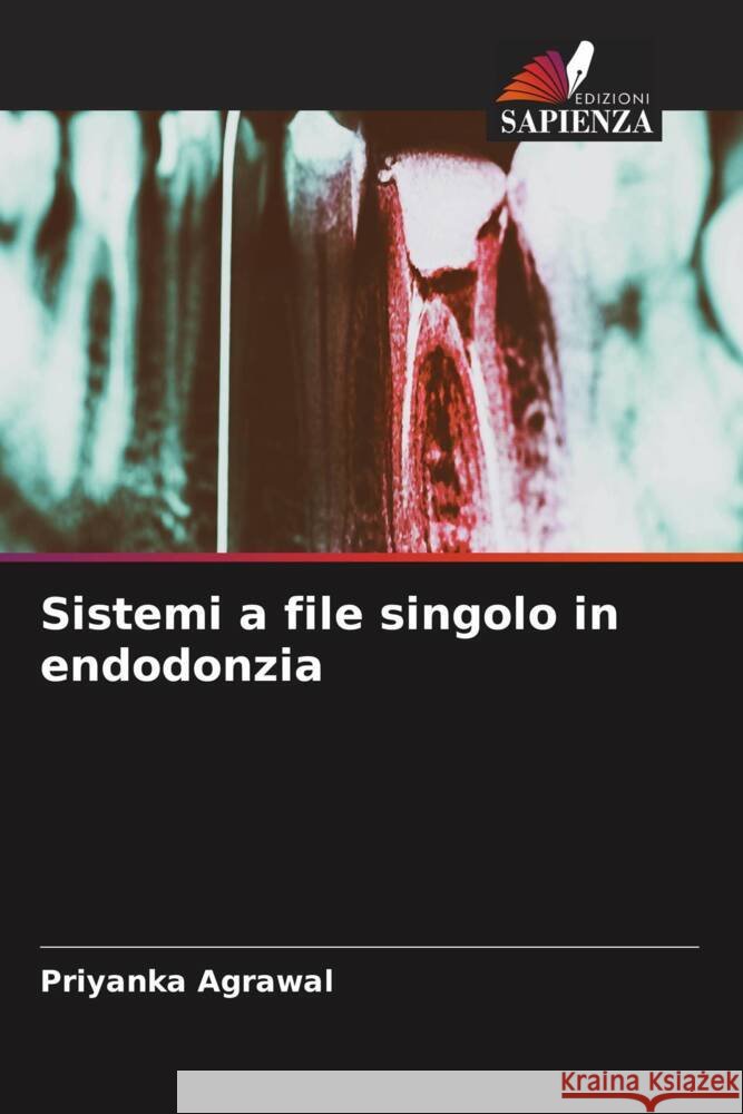 Sistemi a file singolo in endodonzia Agrawal, Priyanka 9786204903491 Edizioni Sapienza - książka