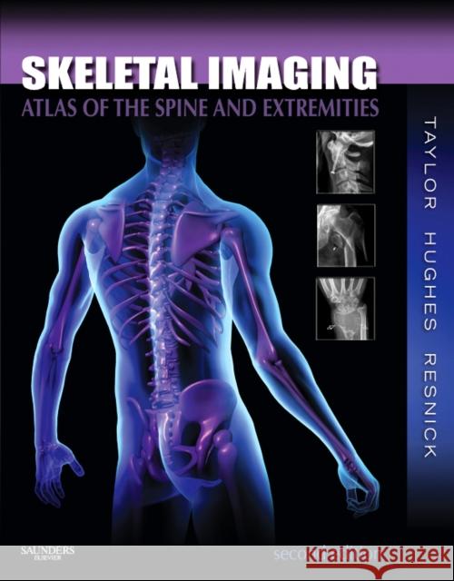 Skeletal Imaging: Atlas of the Spine and Extremities Taylor, John A. M. 9781416056232 W.B. Saunders Company - książka