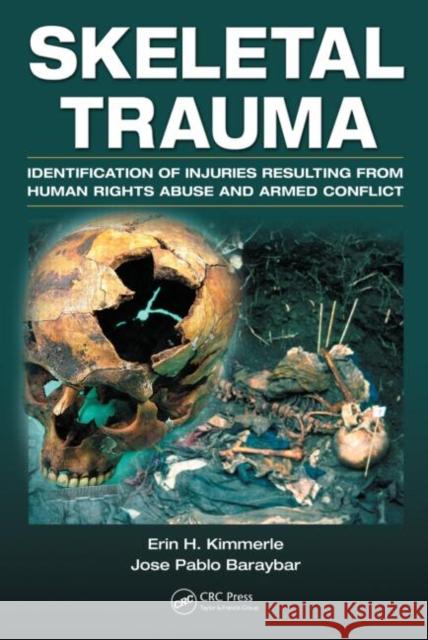 Skeletal Trauma: Identification of Injuries Resulting from Human Rights Abuse and Armed Conflict Kimmerle, Erin H. 9780849392696 CRC - książka